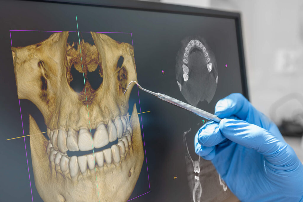 Tomografia komputerowa i obrazowanie zębów i tkanek kostnych za pomocą 