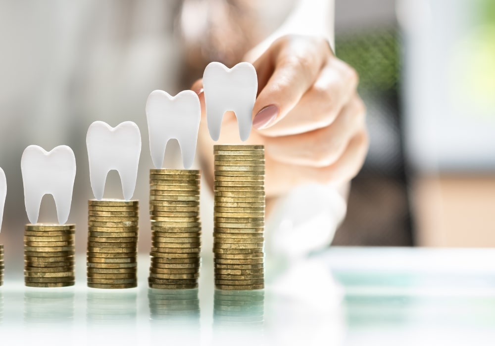 cena implantu zęba
